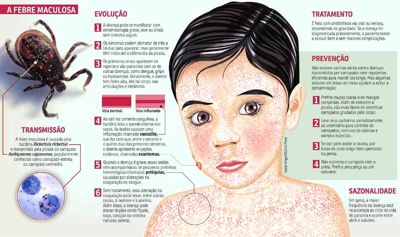Febre maculosa Doença infecciosa com uma erupção característica, muitas vezes transmitida pela picada de um carrapato.